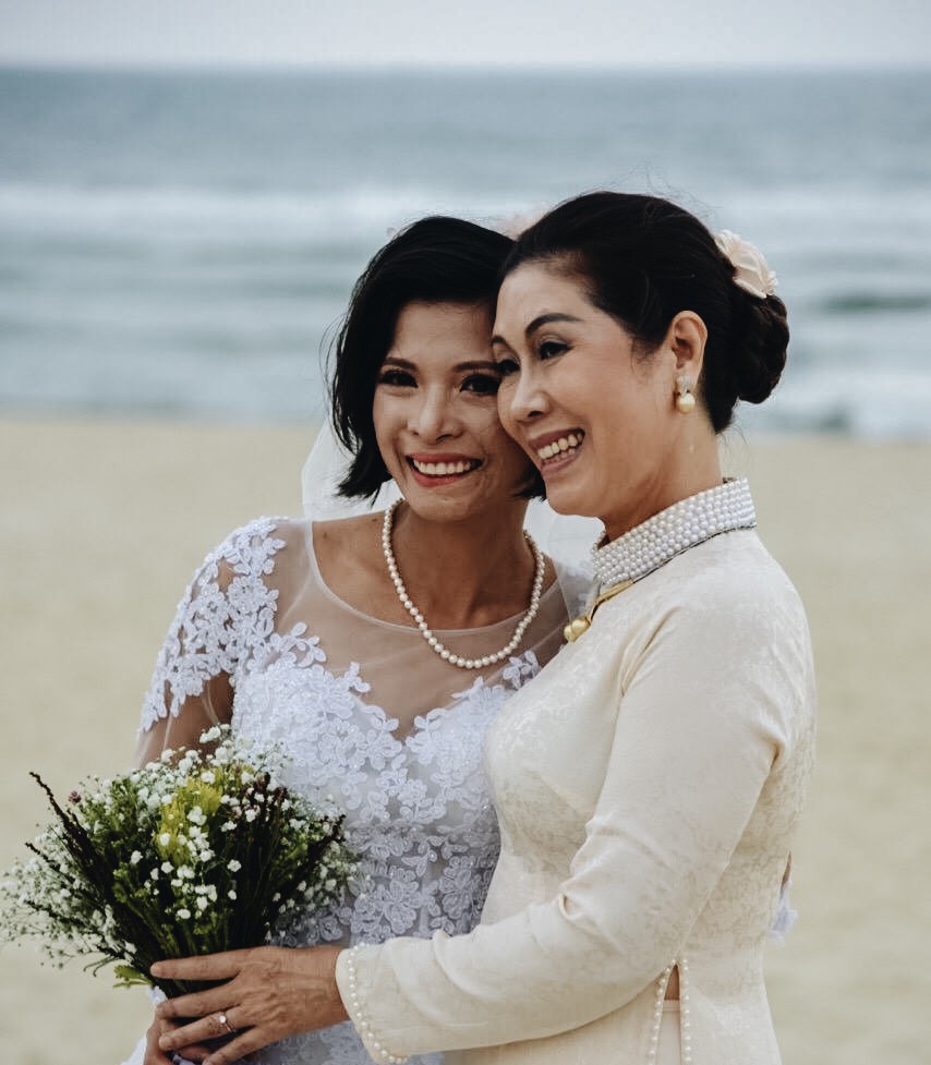 Nghị lực của cô gái từng trải qua gần 10 lần phẫu thuật: Nếu không rơi vào than củi, tôi sẽ không là tôi của ngày hôm nay