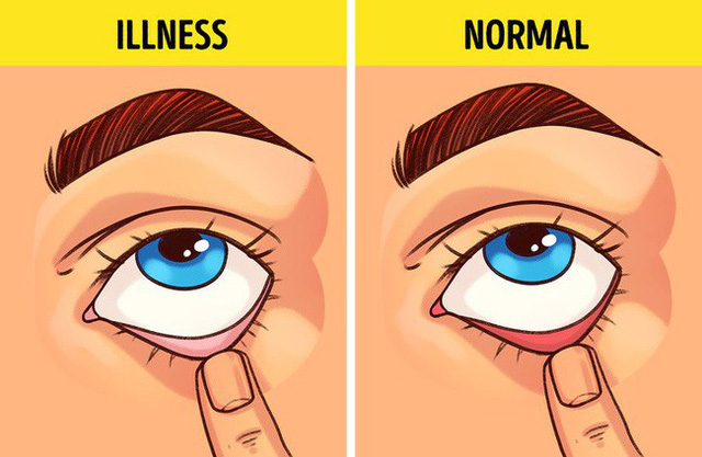 Bài kiểm tra sức khỏe đơn giản bạn có thể tự làm tại nhà để biết mình có bị 9 bệnh này hay không