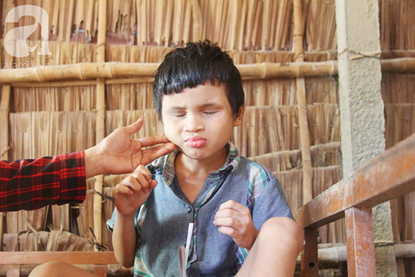 Bố bị chấn thương sọ não, con trai mù 6 tuổi gục đầu lên vai mẹ, ú ớ lấy lá dừa hốt cát để ăn