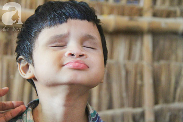 Bố bị chấn thương sọ não, con trai mù 6 tuổi gục đầu lên vai mẹ, ú ớ lấy lá dừa hốt cát để ăn