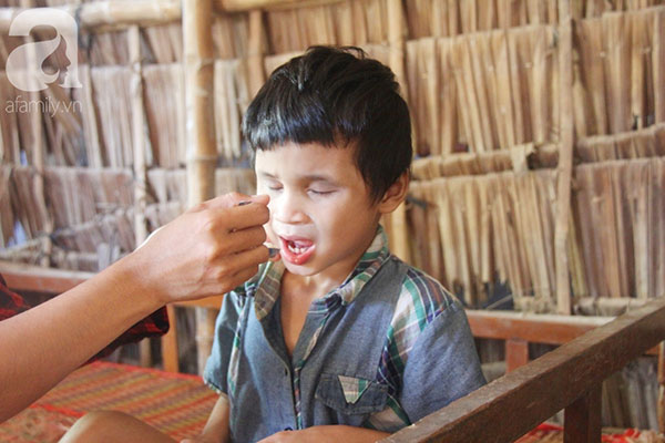 Bố bị chấn thương sọ não, con trai mù 6 tuổi gục đầu lên vai mẹ, ú ớ lấy lá dừa hốt cát để ăn