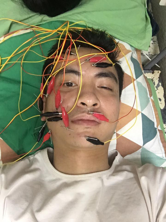 Diễn viên Kiên Trung đột ngột mất tích: Bị liệt nửa cơ mặt, bạn bè thân thiết xa lánh, đàm tiếu