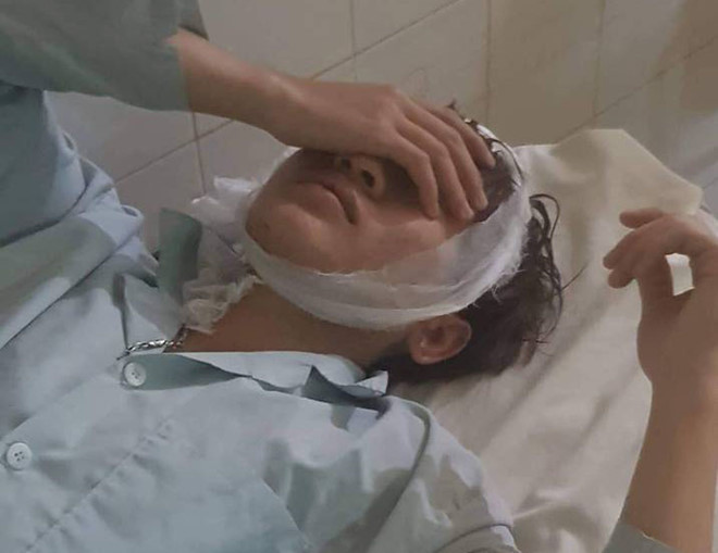 6 người bị chém khi uống cà phê