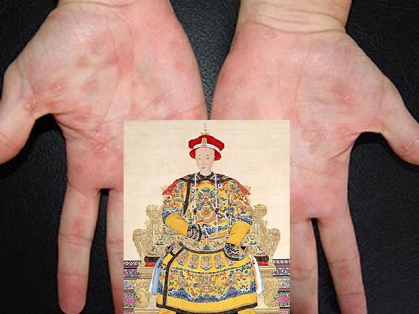 Vua Đồng Trị, con trai duy nhất của Từ Hi Thái Hậu, có thực sự chết vì bệnh giang mai?