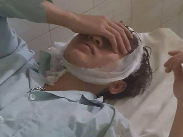 Nhóm người chém 6 thanh niên uống cà phê bị tạm giữ