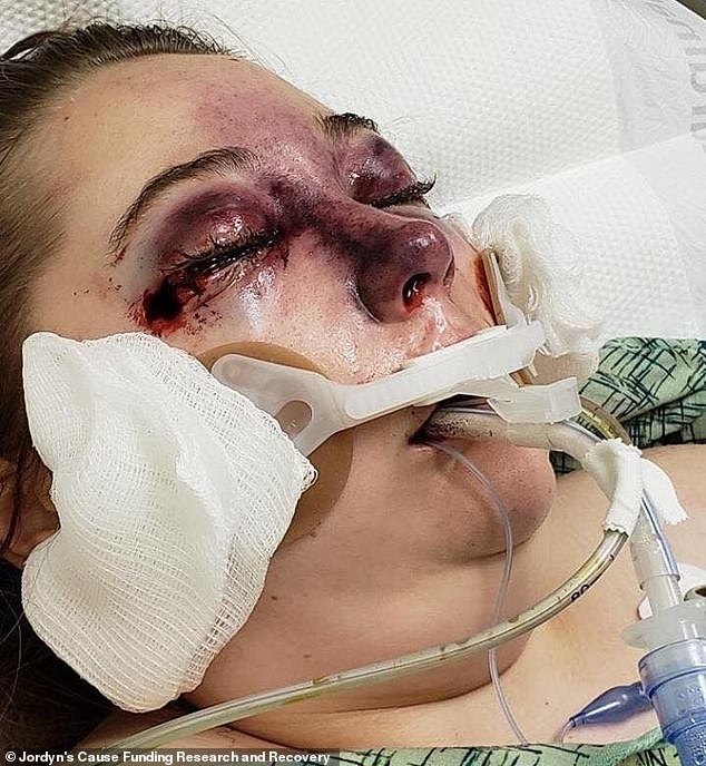 Sau chuyến du lịch cùng gia đình, cô gái 15 tuổi bị mù mắt bí ẩn