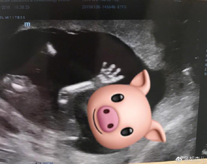 Sau nhiều úp mở, Hồ Hạnh Nhi chính thức báo tin chuẩn bị chào đón bé ỉn con vào năm nay