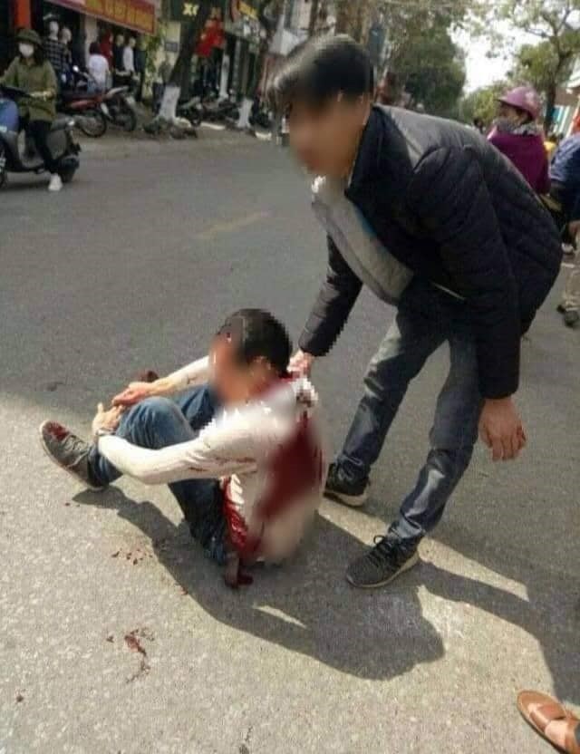 Nam thanh niên bị 2 đối tượng rượt đuổi, chém trọng thương trên phố