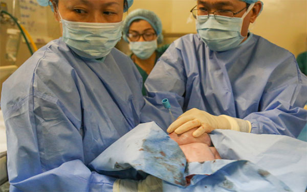 Khối bướu như bộ râu ông già Noel chặn đường thở bé sơ sinh