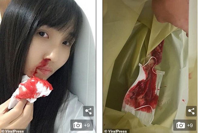 Bangkok tràn ngập khói bụi độc, hắt hơi cũng ra máu