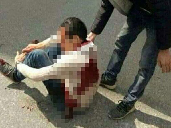 Nam thanh niên bị 2 đối tượng rượt đuổi, chém trọng thương trên phố bị nhiễm HIV