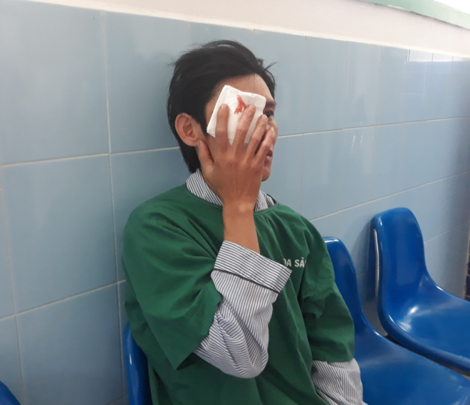 Thanh niên hỏng một mắt do chơi pháo