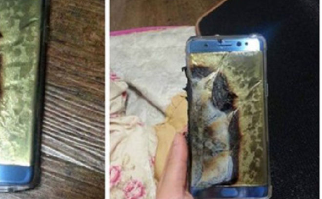 Thiếu niên 16 tuổi bị bỏng nặng do nổ điện thoại khi sạc pin và chơi game