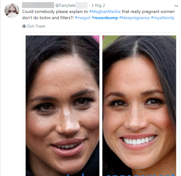 Hết bị chỉ trích vì nghi vấn mang thai giả, Meghan còn liên tục bị người dùng mạng công kích vì những điều này