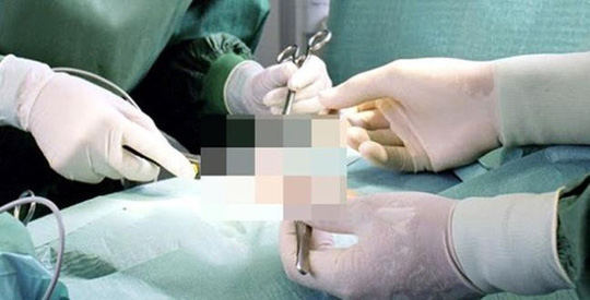 Quý ông U60 bị bạn tình ghen ngược, cắt phăng của quý