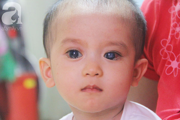 Cái Tết đầu tiên được nhìn thấy ánh sáng mặt trời sau hơn 1 năm mù lòa của bé Gia Anh