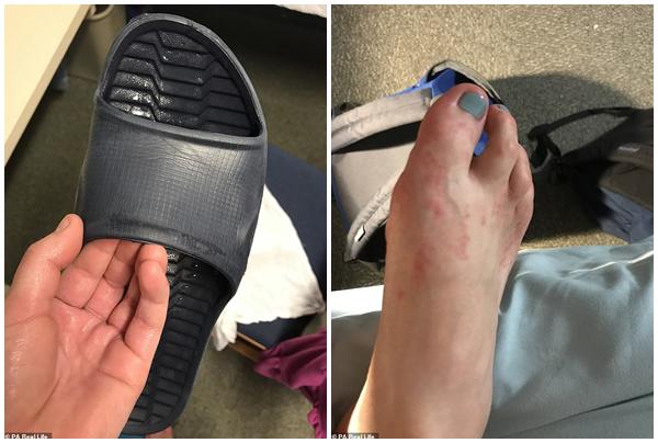 Thiếu nữ trẻ khiến các chàng trai chẳng dám yêu vì cứ động vào người là chảy nước