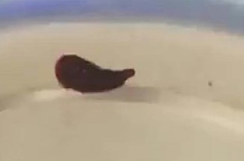 Con vắt dài 5 cm sống trong mũi người phụ nữ