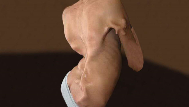 Những chứng bệnh kỳ lạ chưa tìm ra cách chữa trị