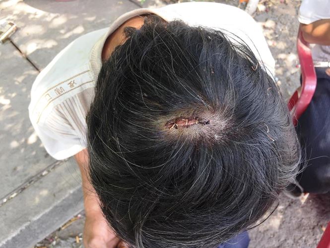 Dùng búa đánh chết bạn rồi thản nhiên ngồi... nhậu tiếp