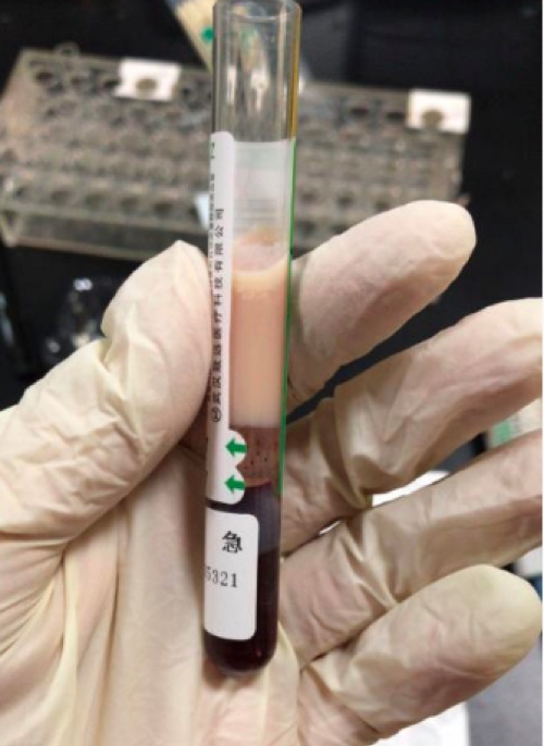 Máu của người phụ nữ trắng như sữa, vì ăn quá nhiều đồ vặt ngày Tết