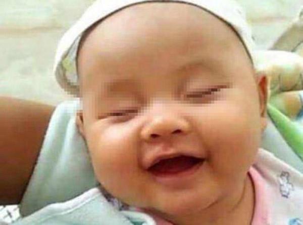 Bé 6 tháng thường cười khi ngủ, bà khen đáng yêu nhưng mẹ đưa đi khám thì hối hận