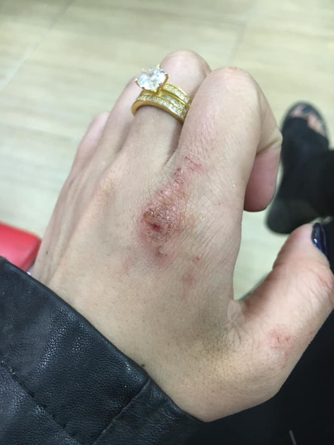 Tố chồng vũ phu đánh ngược cả vợ khi bị bắt ngoại tình tại nhà nghỉ, vợ trẻ sốc nặng khi cư dân mạng đột nhiên dành sự chú ý cho thứ này...