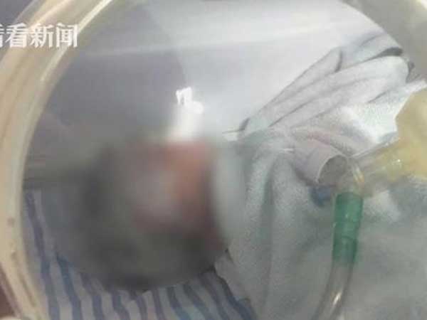 Mẹ bầu song thai nhập viện vì mắc cúm, bác sĩ tức tốc làm ngay việc này để cứu mạng