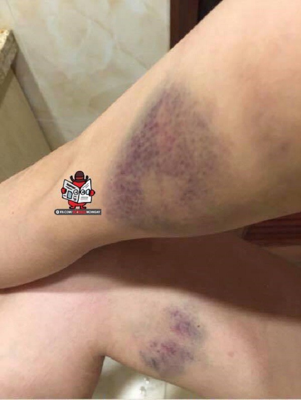 Vụ ghen ngược kinh hoàng nhất từ trước đến nay, chính thất không những bị ăn đòn còn được gọi là con đẻ thuê