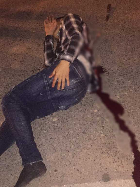 Nam Định: Vừa bước ra từ quán ăn, nam thanh niên bị nhóm đối tượng đâm gần đứt đôi thận trái