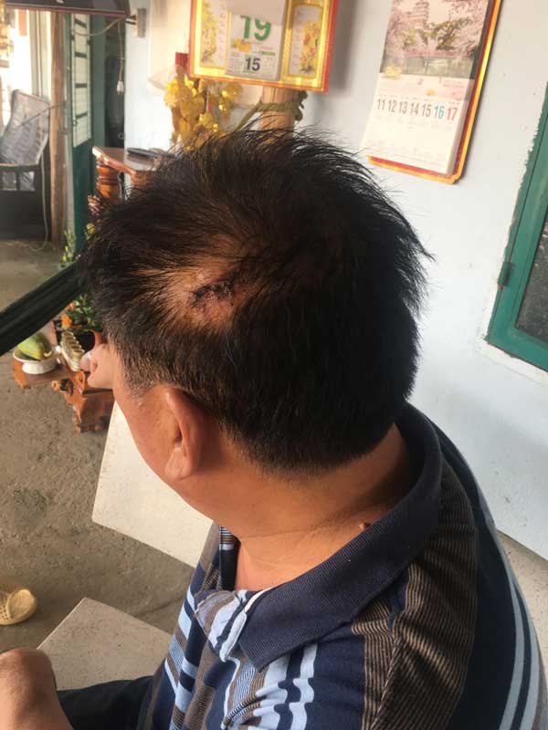 Giám đốc doanh nghiệp ở Sài Gòn bị giang hồ truy sát