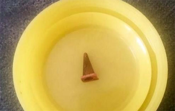 Người đàn ông bị chẩn đoán ung thư phổi, thủ phạm khiến nhiều người bất ngờ