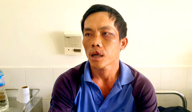 Nạn nhân bị trói và phơi nắng trên xe bán tải nhập viện cấp cứu