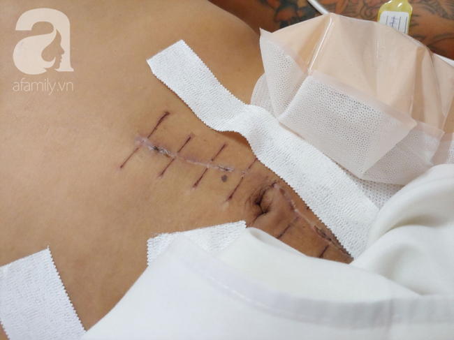 Tai nạn kinh hoàng: Chàng trai 25 tuổi bị xe lam chở rác ép dính vào tường, thủng bụng nguy kịch