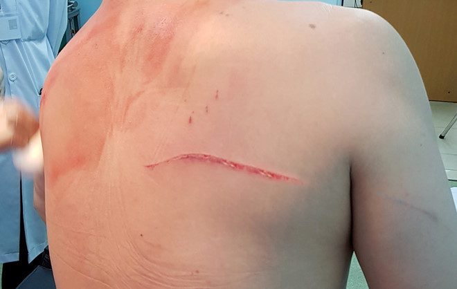 VKS lại trả hồ sơ điều tra vụ truy sát bác sĩ Chiêm Quốc Thái