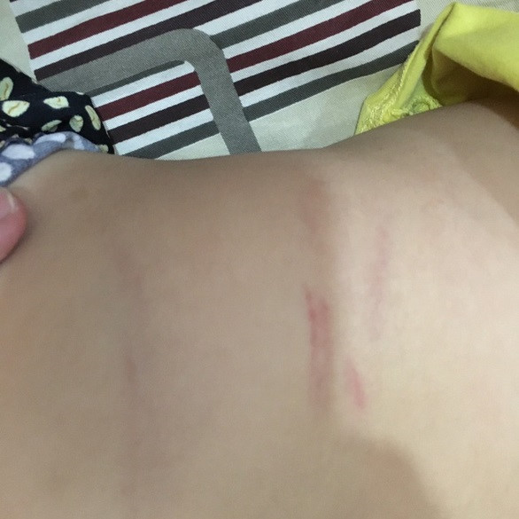 Phụ huynh có nên kiện trường ra tòa, đòi 100 triệu vì con bị đánh?