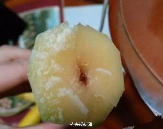 Người phụ nữ suy đa tạng sau ăn mía, cảnh báo nên vứt bỏ nếu có dấu hiệu này