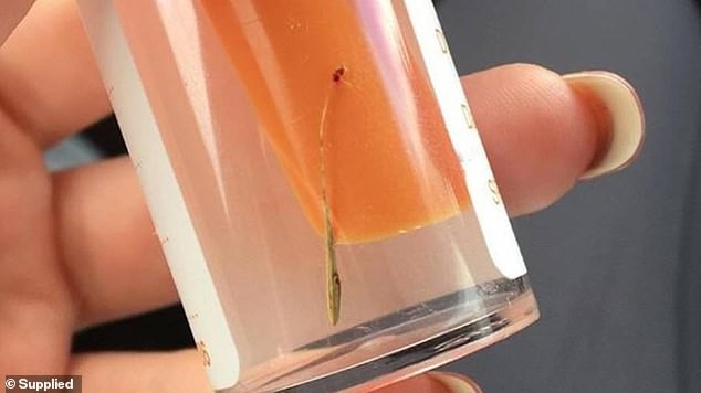 Những ca bệnh hi hữu tưởng chừng chỉ có trong phim viễn tưởng nhưng lại lộ diện khiến mọi người bàng hoàng