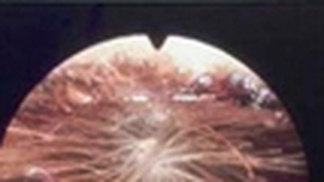 Những ca bệnh hi hữu tưởng chừng chỉ có trong phim viễn tưởng nhưng lại lộ diện khiến mọi người bàng hoàng