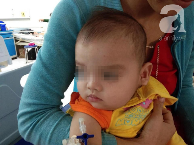 Người mẹ Sài Gòn đau khổ tột cùng vì con trai 12 tháng tuổi mang gương mặt quỷ, má phình to như quả bưởi