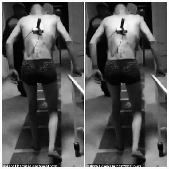 Bệnh nhân bị dao đâm chạy khỏi phòng cấp cứu vì thèm thuốc lá