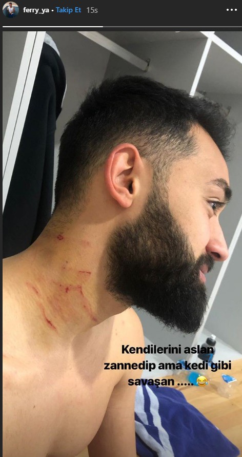 Cầu thủ mang theo dao cạo cứa cổ đối phương ngay trên sân