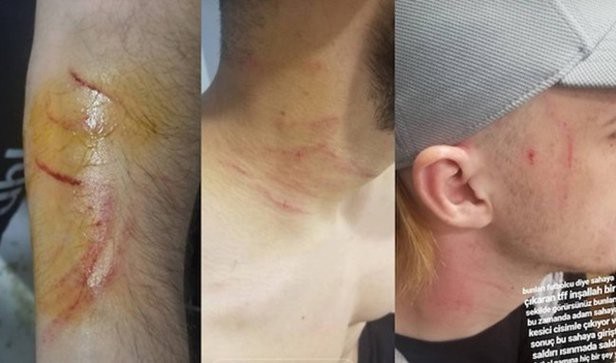 Cầu thủ mang theo dao cạo cứa cổ đối phương ngay trên sân