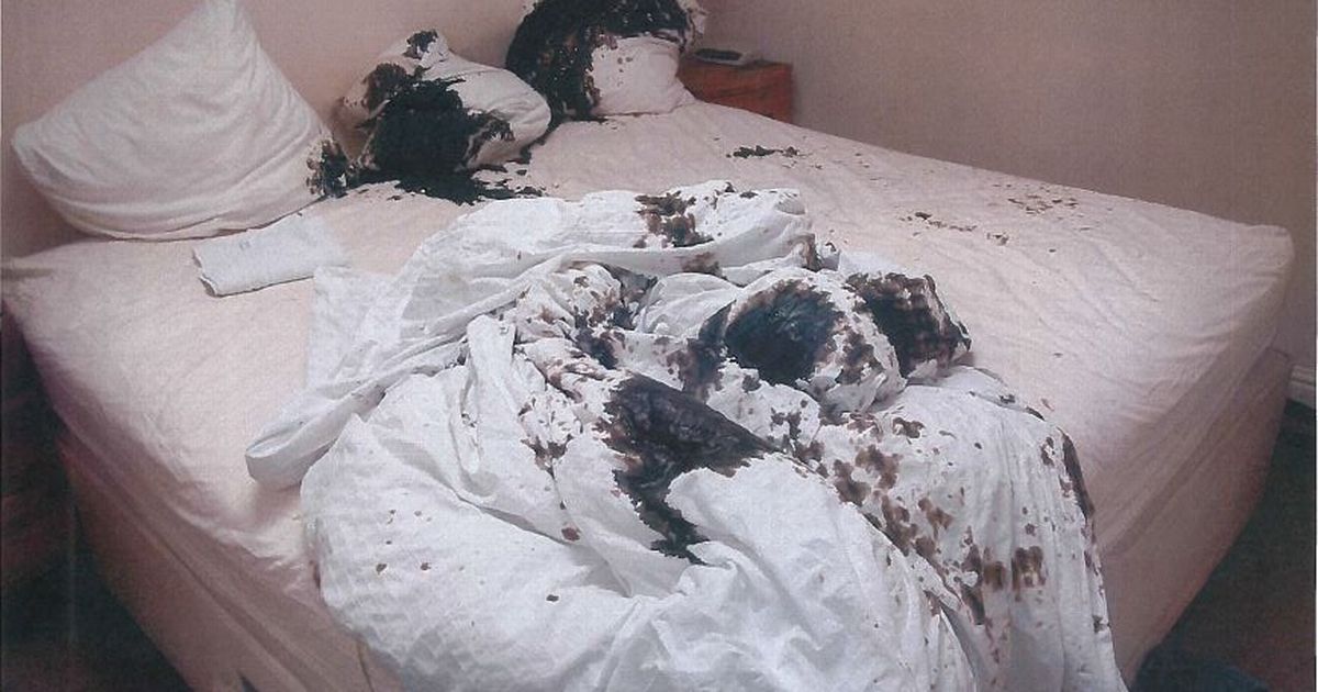 Đau đớn vì bị tình cũ đổ axit vào mặt, phi công cầu xin bác sĩ được chết