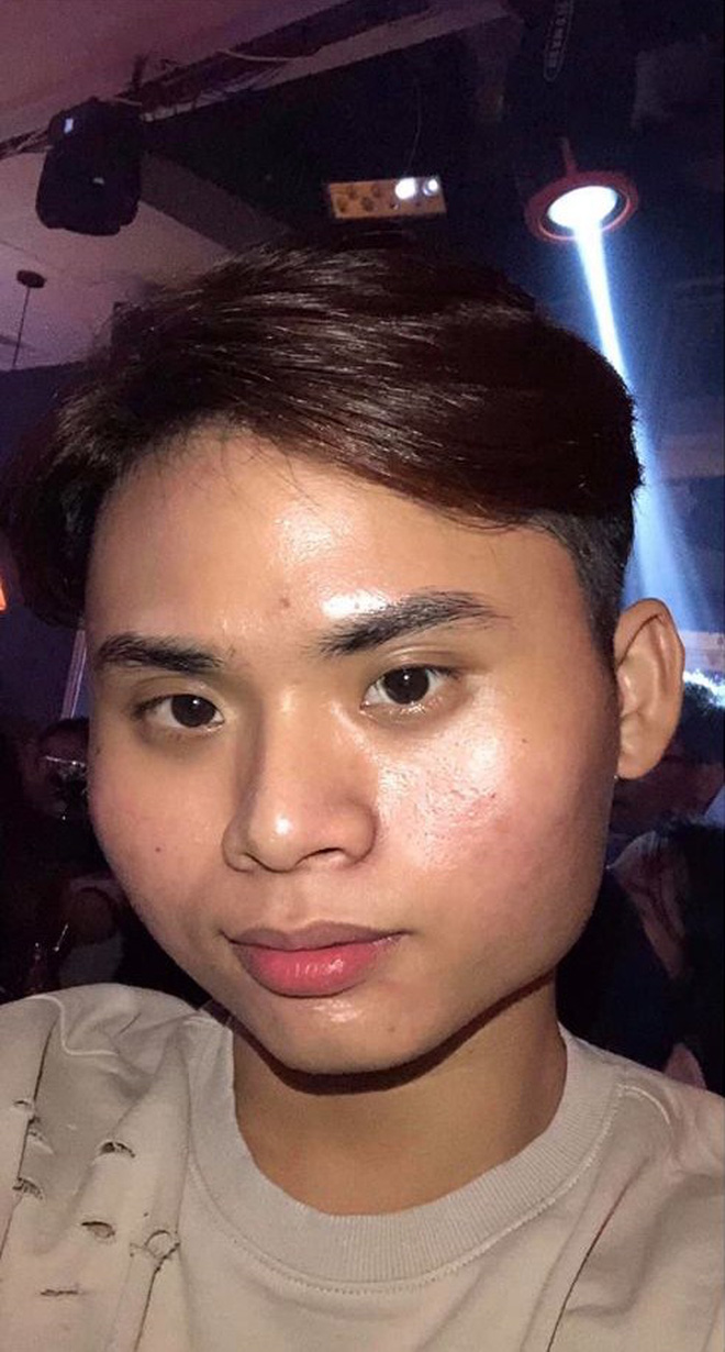 Chi 160 triệu và cả tháng trời không thể đánh răng: Câu chuyện về chàng trai trẻ PTTM vì nỗi tự ti mặt vuông gây sốt cộng đồng mạng