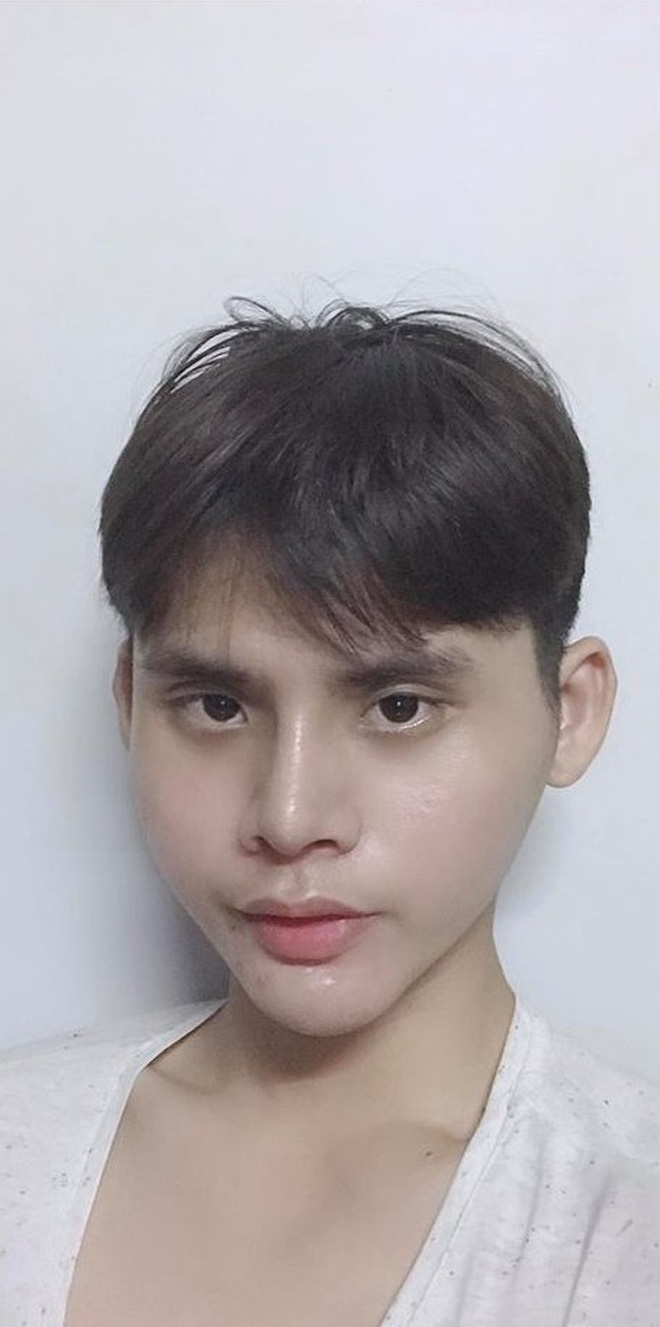 Chi 160 triệu và cả tháng trời không thể đánh răng: Câu chuyện về chàng trai trẻ PTTM vì nỗi tự ti mặt vuông gây sốt cộng đồng mạng