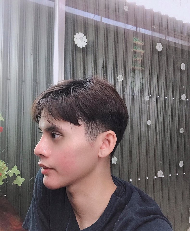 Chi 160 triệu và cả tháng trời không thể đánh răng: Câu chuyện về chàng trai trẻ PTTM vì nỗi tự ti mặt vuông gây sốt cộng đồng mạng