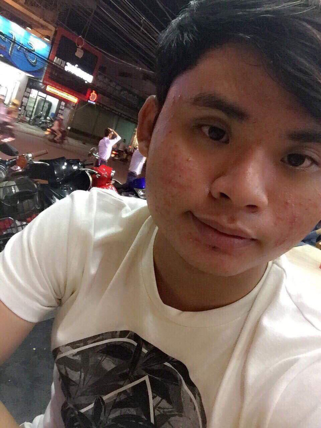 Chi 160 triệu và cả tháng trời không thể đánh răng: Câu chuyện về chàng trai trẻ PTTM vì nỗi tự ti mặt vuông gây sốt cộng đồng mạng