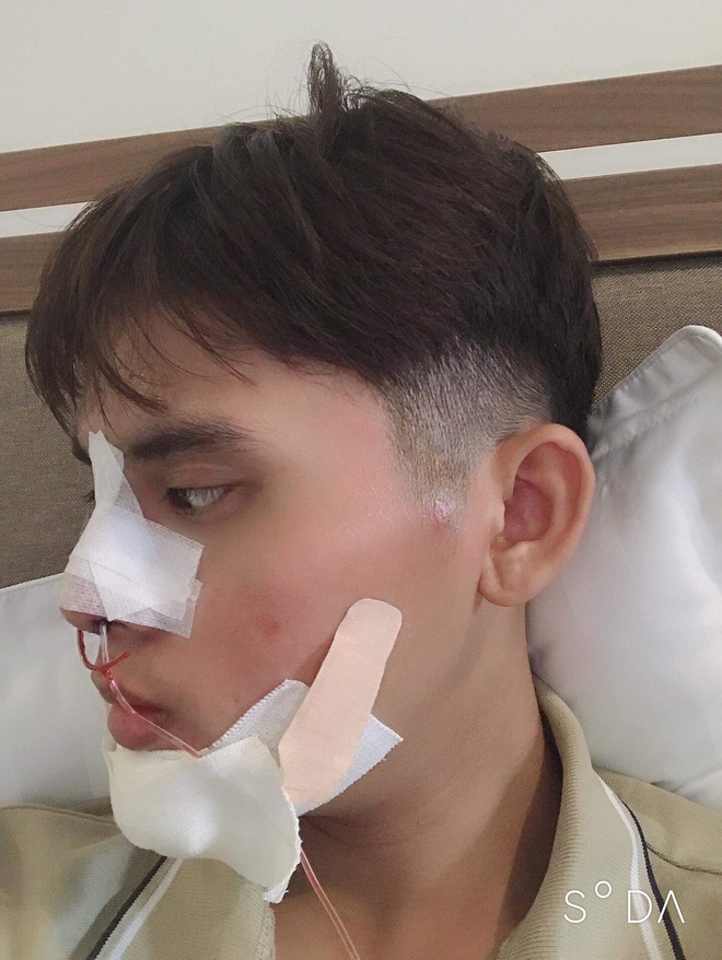 Chi 160 triệu và cả tháng trời không thể đánh răng: Câu chuyện về chàng trai trẻ PTTM vì nỗi tự ti mặt vuông gây sốt cộng đồng mạng