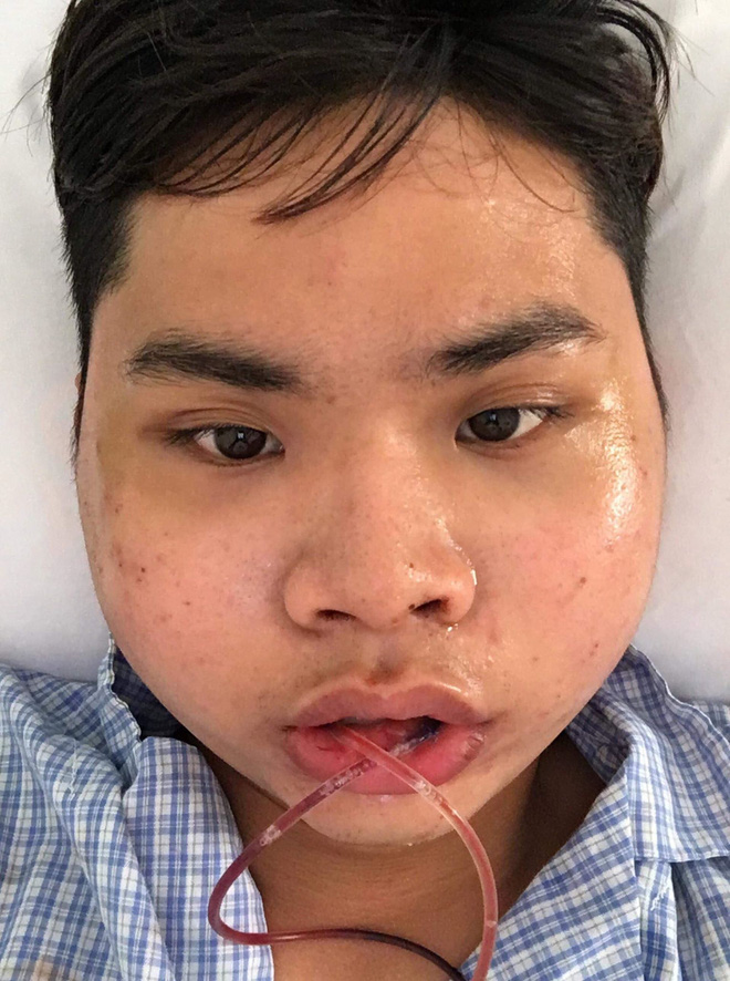 Chi 160 triệu và cả tháng trời không thể đánh răng: Câu chuyện về chàng trai trẻ PTTM vì nỗi tự ti mặt vuông gây sốt cộng đồng mạng